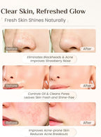Rena Chris 3 pcs Silicone Face Scrubber, 3 in 1 Face Mask Applicator & Facial - Image 4
