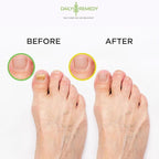 DAILY REMEDY EXTRA STRENGTH Tea Tree Oil & Citrus Detox Foot Soak Set - Image 6