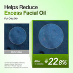 Anua Azelaic Acid 10 Hyaluron Redness Soothing Serum, Facial Serum - Image 6