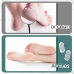 Moxweyeni 8 Pack Silver Foot File Callus Remover Replacement Blades Metal File - Image 4