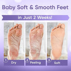 CÉLOR Foot Peeling Mask for Dry Cracked Feet | Foot Mask to Exfoliate Rough - Image 2