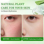 Aloe Vera Face Masks Skincare Soothing & Hydrating Face Masks Aloe Face Mask - Image 5
