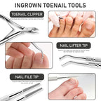 Ingrown Toenail Tool Kit, Ingrown Toenail Removal Kit: Ingrown Toenail Clippers - Image 3