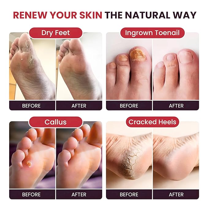 FOOT CURE Muscle Care Foot Soak - Image 5