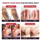 FOOT CURE Foot Soak with Epsom Salts – All-Natural Blend - Image 4