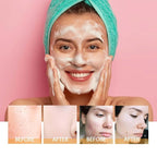 2 Pcs Turmeric Facial Cleanser, Glow Wash Turmeric Face Wash - Image 5