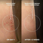 Bushbalm Ingrown Hair Exfoliating Scrub - Image 2