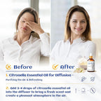 HIQILI 1 Fl Oz Citronella Essential Oil, 100% Pure Undiluted - Image 2