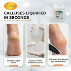 SPA REDI - Callus Remover for Feet Gel, Mint and Eucalyptus, 128 Oz - - Image 2