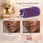 African Net Sponge Authentic, 3 Pieces African Exfoliating Net Sponge Body Back - Image 5