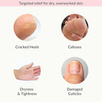 Epielle Moisturizing Hand & Foot Masks, Soften Dry Skin - Image 4