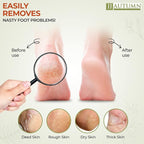 Spa Quality Foot Rasp/Callus Remover Double Sided Wood Professional Foot File - Image 3