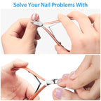 Mudder 3 Pack Rose Gold Cuticle Trimmer Nippers Cutter Tool Stainless Steel - Image 2