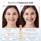 grace & stella Award Winning Hyaluronic Acid Face Serum Removes Fine Lines & - Image 4