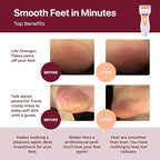 Rechargeable Callus Remover for Feet: Professional Electric Feet Sander for - Image 2