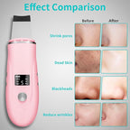 Face Scrubber Skin Spatula - Image 3