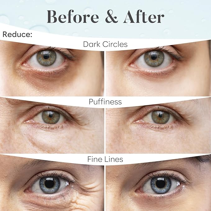 AURAE Hyaluronic Acid Under Eye Patches - Image 4