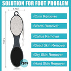 Foot File Callus Remover-2 Pcs 4 in 1 Foot Scrubber Dead Skin Remover - Image 3