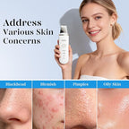 GUGUG Skin Scrubber Face Spatula Skin Spatula Pore Cleaner Blackhead Remover - Image 4