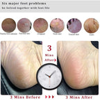 Kinepi Foot File Callus Remover Foot Scrubber, Professional Pedicure Foot Rasp - Image 3
