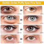 Permotary 30 Pairs 24K Gold Eye Masks & Lip Mask, Under Eye Patches and Lip Pads - Image 4
