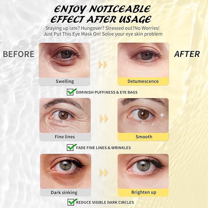 Maskiss Under Eye Patches, Hyaluronic Acid Eye Masks - Image 4