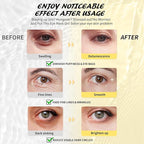 Maskiss Under Eye Patches, 24K Gold, Hyaluronic Acid, Aloe Vera Eye Masks - Image 3