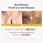 medicube Body Peel Shot with Kojic Acid and Turmeric | Gentle Body Brightening - Image 5