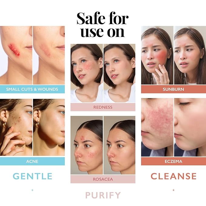 Hypochlorous Acid Spray for Face and Skin; Facial Cleanser | 2oz Face Mist - Image 3