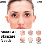 Facial Cleansing Brush Portable Waterproof Rechargeable Face Wash Brush - Image 3