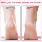 Electric Foot File and Callus Remover, Professional Pedicure Tools - Image 3