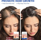 HIQILI 1000ML Rosemary Oil for Hair Growth, Add to Shampoo & Conditioner - Image 2
