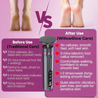 Professional Electric Foot Callus Remover, 9-Speed Cordless Foot File - Image 4