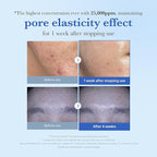 medicube Exosome Shot Zero 25, 000 PPM Spicule Facial Serum | Liquid Skin - Image 2