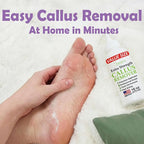 Dr. Entre's 16oz Callus Remover Gel: Extra Strength Value Size, Callus Remover - Image 5