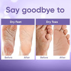 CÉLOR Foot Peeling Mask for Dry Cracked Feet | Foot Mask to Exfoliate Rough - Image 4