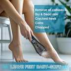 Electric Foot File Callus Remover - Image 6
