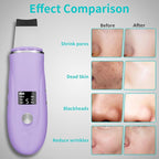 Face Scrubber Skin Spatula - Image 4