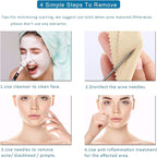 5PCS Blackhead Remover Comedone Extractor, Curved Blackhead Tweezers Kit - Image 9