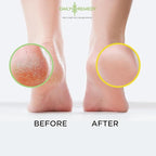 DAILY REMEDY 4-Pack Foot Soak Set - Image 5