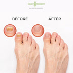 Muscle Relief Foot Soak with Epsom Salt, Made in USA, Soothe Tired Feet - Image 6