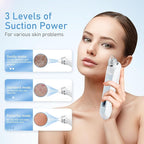 Facial Pore Blackhead Remover Vacuum, 1080P Camera Blackhead Remover, 20x Zoom - Image 3