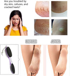 Foot File Callus Remover 4-in-1, Feet Scraper Pedicure Tools - Image 3