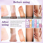 Pedicure Foot Soak Set - Image 4