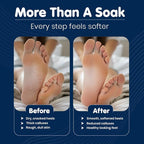 Imperial Feet Epsom Salt Foot Soak-Cracked Heels, Thick Calluses, Soften Hard - Image 4