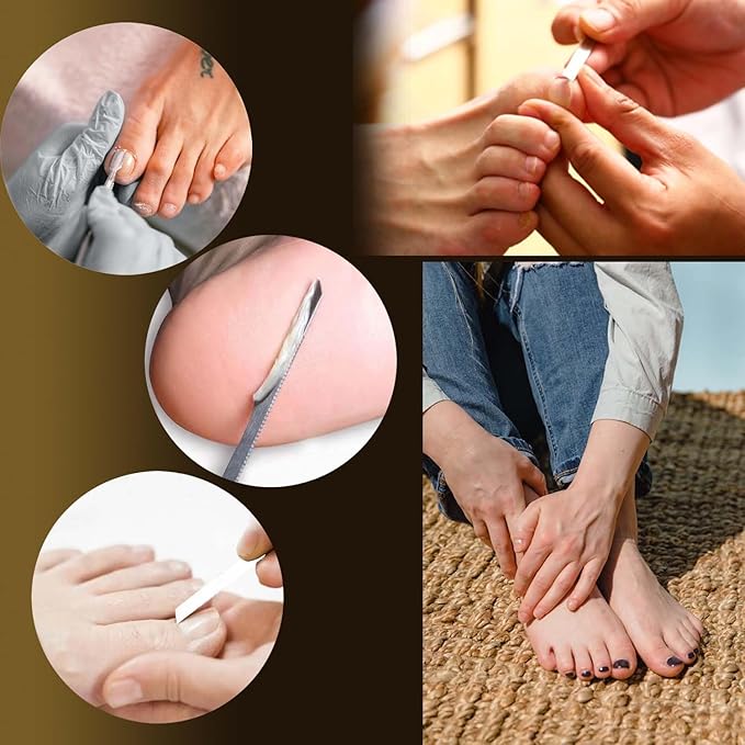 10-Pack Ingrown Toenail Tools Stainless Steel Foot Nail Tools, Heavy Duty Sharp - Image 5