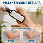TEAWOO Foot File Callus Remover, Large Stainless Steel Foot Rasp, Heavy Duty - Image 6