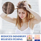 HIQILI Rosemary Oil for Hair Growth, Add to Shampoo & Conditioner, 100% Pure - Image 4