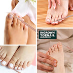 Teenitor Pedicure Tools for Feet, Toenail File and Lifters, Ingrown Toenail - Image 7