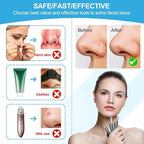 Blackhead Remover Tools Pimple Popper Tool Kit Comedones Extractor Acne Removal - Image 2